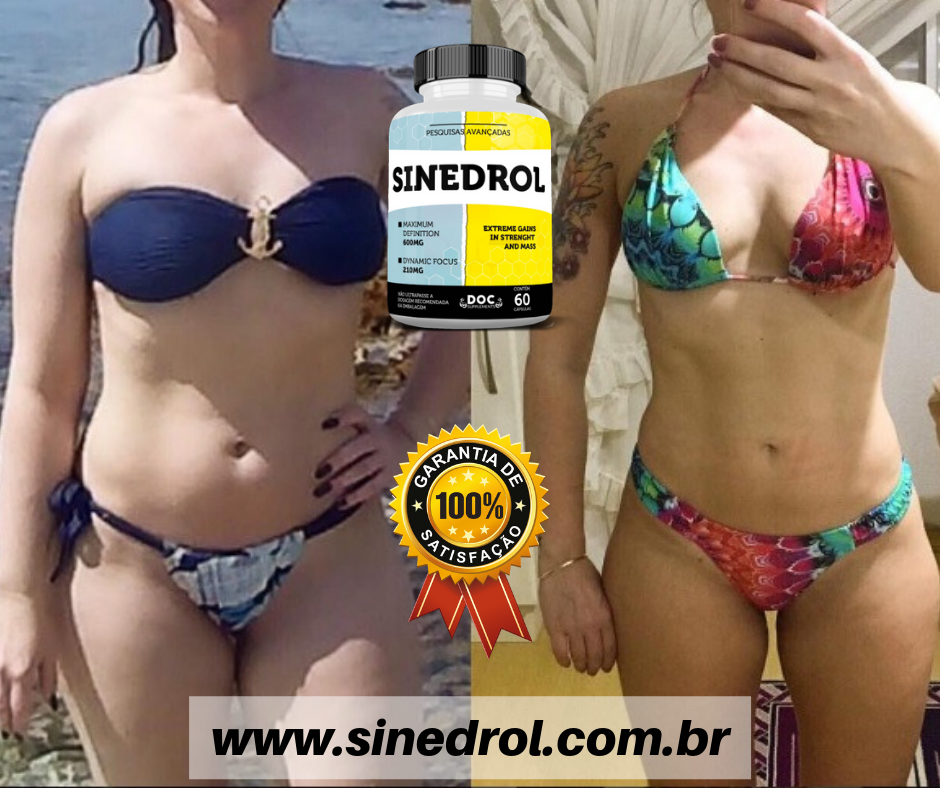 Antes e Depois (13)