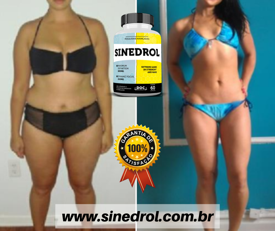 Antes e Depois (14)