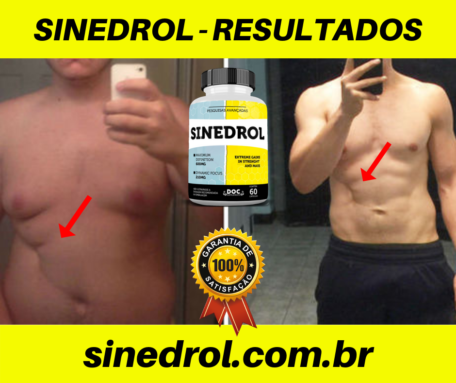 Antes e Depois (20)