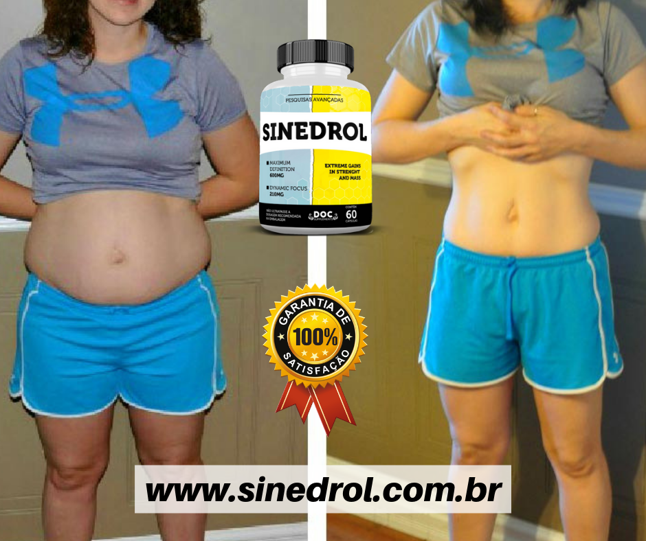 Antes e Depois (22)